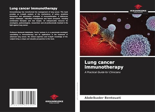 Lung cancer immunotherapy: A Practical Guide for Clinicians von Our Knowledge Publishing