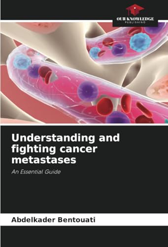 Understanding and fighting cancer metastases: An Essential Guide von Our Knowledge Publishing