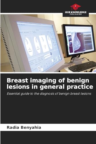 Breast imaging of benign lesions in general practice: Essential guide to the diagnosis of benign breast lesions von Our Knowledge Publishing
