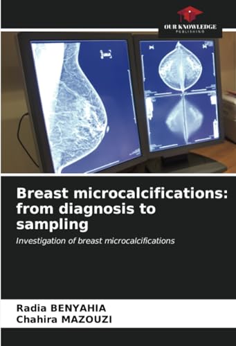 Breast microcalcifications: from diagnosis to sampling: Investigation of breast microcalcifications von Our Knowledge Publishing