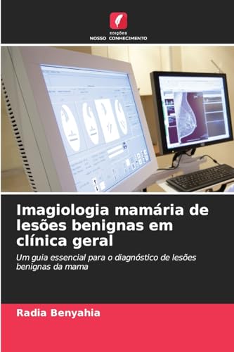 Imagiologia mamária de lesões benignas em clínica geral: Um guia essencial para o diagnóstico de lesões benignas da mama von Edições Nosso Conhecimento
