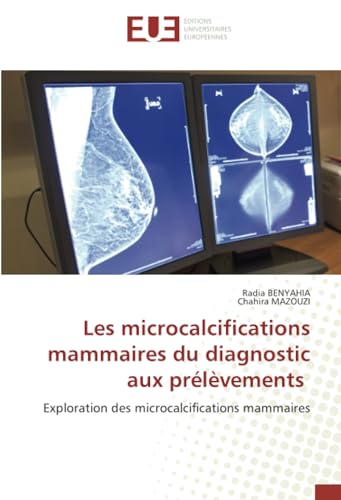 Les microcalcifications mammaires du diagnostic aux prélèvements: Exploration des microcalcifications mammaires von Éditions universitaires européennes