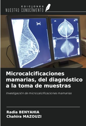 Microcalcificaciones mamarias, del diagnóstico a la toma de muestras: Investigación de microcalcificaciones mamarias von Ediciones Nuestro Conocimiento
