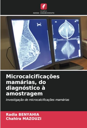 Microcalcificações mamárias, do diagnóstico à amostragem: Investigação de microcalcificações mamárias von Edições Nosso Conhecimento