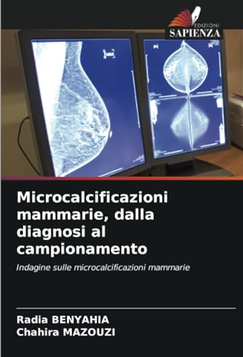 Microcalcificazioni mammarie, dalla diagnosi al campionamento: Indagine sulle microcalcificazioni mammarie von Edizioni Sapienza