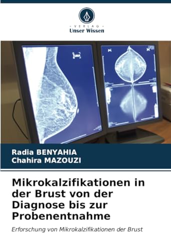 Mikrokalzifikationen in der Brust von der Diagnose bis zur Probenentnahme: Erforschung von Mikrokalzifikationen der Brust von Verlag Unser Wissen