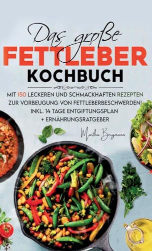 Das große Fettleber Kochbuch: Mit 150 leckeren und schmackhaften Rezepten zur Vorbeugung von Fettleberbeschwerden! Inkl. 14 Tage Entgiftungsplan und Ernährungsratgeber! von tredition