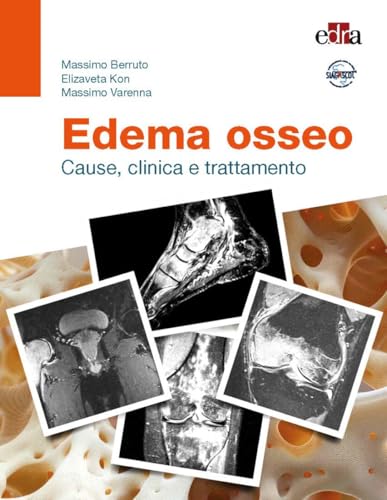 Edema osseo. Cause, clinica e trattamento von Edra