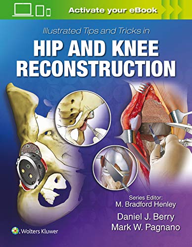 Illustrated Tips and Tricks in Hip and Knee Reconstructive and Replacement Surgery von Lippincott Williams & Wilkins