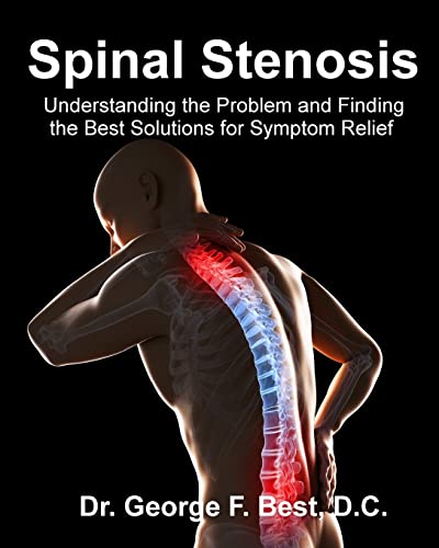 Spinal Stenosis: Understanding the Problem and Finding the Best Solutions for Symptom Relief von CREATESPACE