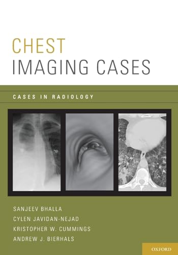Chest Imaging Cases (Cases in Radiology) von Oxford University Press, USA