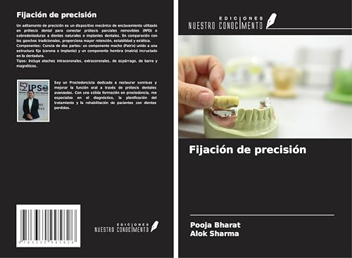 Fijación de precisión von Ediciones Nuestro Conocimiento
