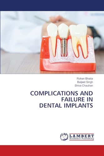 COMPLICATIONS AND FAILURE IN DENTAL IMPLANTS von LAP LAMBERT Academic Publishing