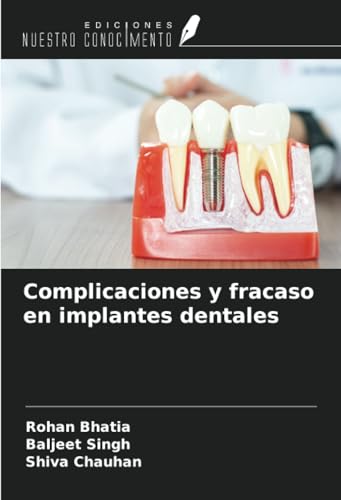 Complicaciones y fracaso en implantes dentales von Ediciones Nuestro Conocimiento