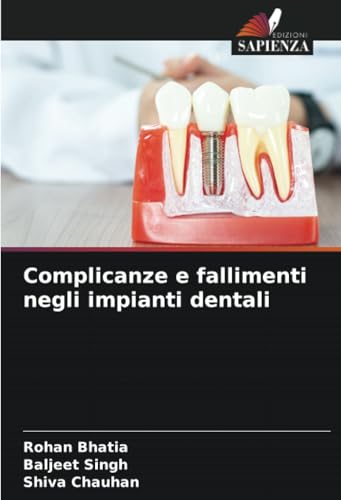 Complicanze e fallimenti negli impianti dentali von Edizioni Sapienza