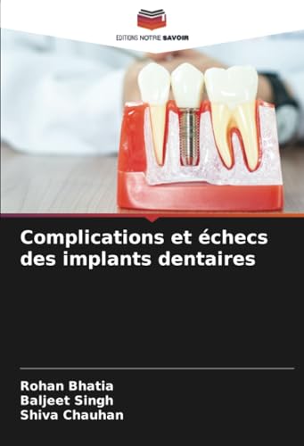 Complications et échecs des implants dentaires von Editions Notre Savoir