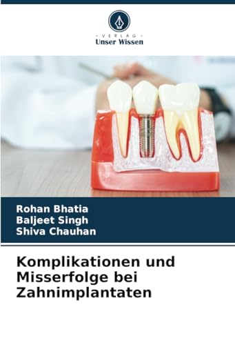 Komplikationen und Misserfolge bei Zahnimplantaten: DE von Verlag Unser Wissen