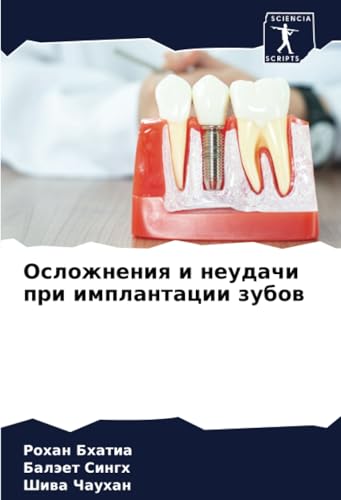 Осложнения и неудачи при имплантации зубов: DE von Sciencia Scripts