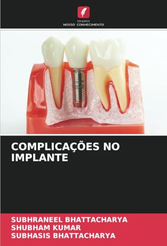 COMPLICAÇÕES NO IMPLANTE: DE von Edições Nosso Conhecimento