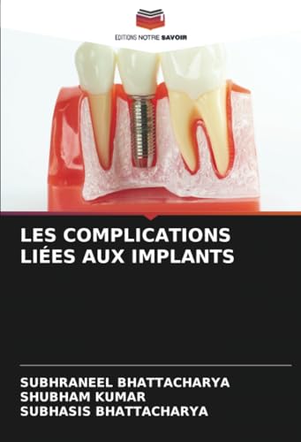 LES COMPLICATIONS LIÉES AUX IMPLANTS: DE von Editions Notre Savoir