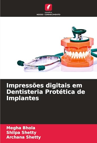 Impressões digitais em Dentisteria Protética de Implantes von Edições Nosso Conhecimento