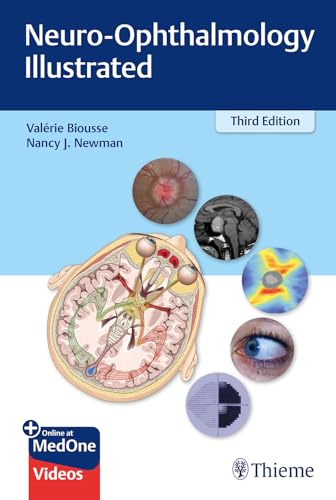 Neuro-Ophthalmology Illustrated: Mit Online-Zugang von Thieme Medical Publishers