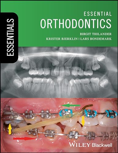 Essential Orthodontics (Dentistry Essentials)