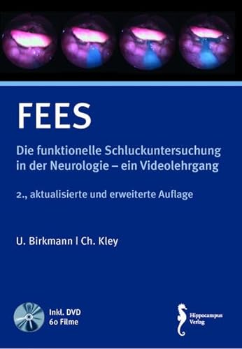 FEES: Die funktionelle Schluckuntersuchung in der Neurologie – Ein Videolehrgang von Hippocampus