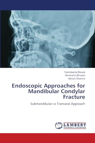 Endoscopic Approaches for Mandibular Condylar Fracture: Submandibular vs Transoral Approach von LAP LAMBERT Academic Publishing
