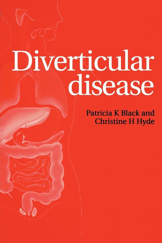 Diverticular Disease von John Wiley & Sons