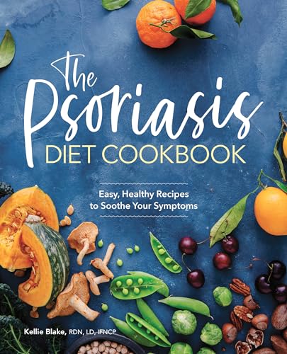 The Psoriasis Diet Cookbook: Easy, Healthy Recipes to Soothe Your Symptoms von Rockridge Press