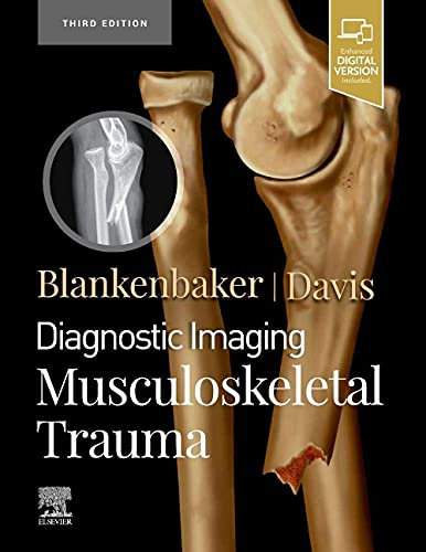 Diagnostic Imaging: Musculoskeletal Trauma von Elsevier