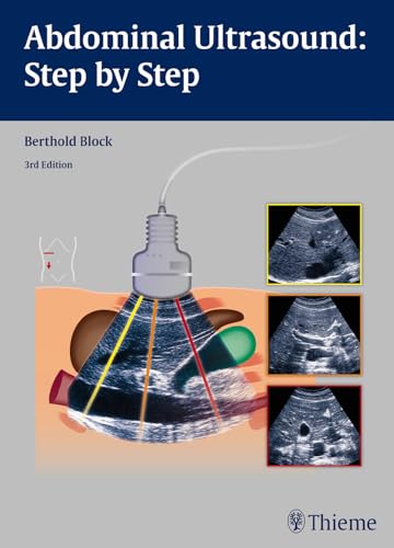 Abdominal Ultrasound: Step by Step von Georg Thieme Verlag