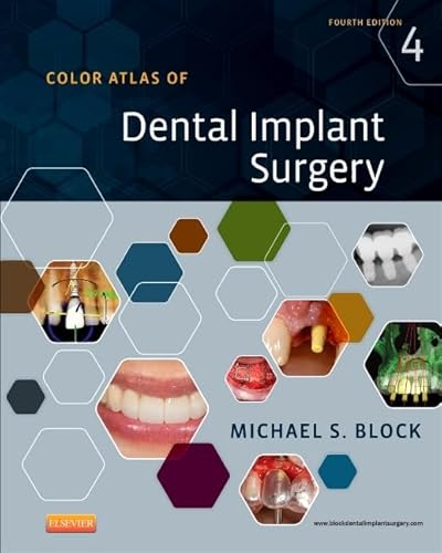 Color Atlas of Dental Implant Surgery von Saunders