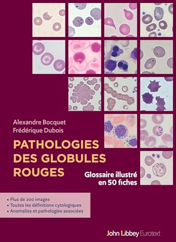 Pathologies des globules rouges: Glossaire illustré en 50 fiches von JOHN LIBBEY