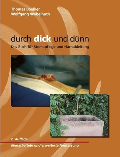 durch dick und dünn: Das Buch für Stomapflege und Harnableitung