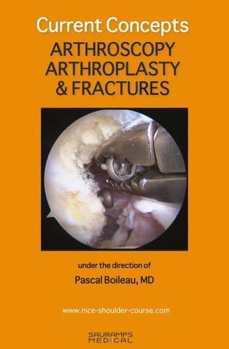 CURRENT CONCEPTS. ARTHROSCOPY, ARTHROPLASTY & FRACTURES: COLL NICE SHOULDER von SAURAMPS MEDICA