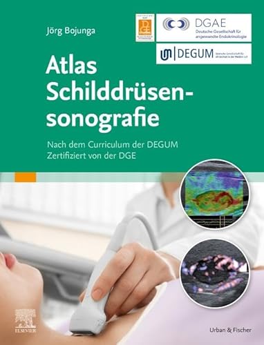 Atlas Schilddrüsensonografie: Nach dem Curriculum der DGUM. Zertifiziert von der DGE von Elsevier
