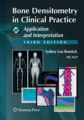 Bone Densitometry in Clinical Practice: Application and Interpretation (Current Clinical Practice) von Humana