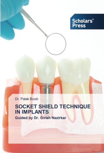 SOCKET SHIELD TECHNIQUE IN IMPLANTS: Guided by Dr. Girish Nazirkar von Scholars' Press