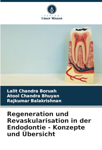 Regeneration und Revaskularisation in der Endodontie - Konzepte und Übersicht von Verlag Unser Wissen