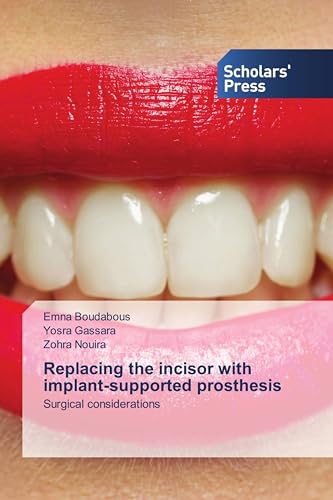 Replacing the incisor with implant-supported prosthesis: Surgical considerations von Scholars' Press