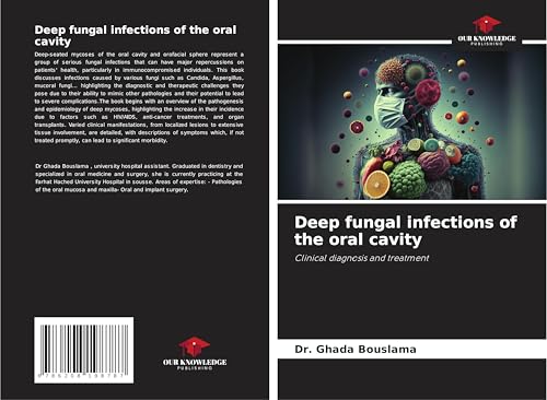 Deep fungal infections of the oral cavity: Clinical diagnosis and treatment