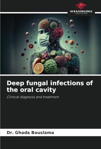 Deep fungal infections of the oral cavity: Clinical diagnosis and treatment von Our Knowledge Publishing