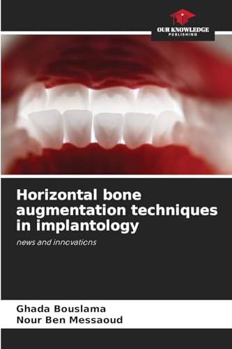 Horizontal bone augmentation techniques in implantology: news and innovations von Our Knowledge Publishing