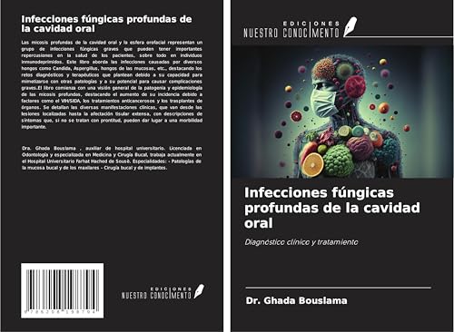 Infecciones fúngicas profundas de la cavidad oral: Diagnóstico clínico y tratamiento