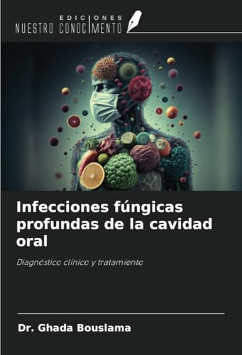 Infecciones fúngicas profundas de la cavidad oral: Diagnóstico clínico y tratamiento Infecciones fúngicas profundas de la cavidad oral: Diagnóstico clínico y tratamiento