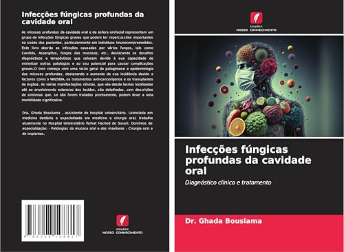 Infecções fúngicas profundas da cavidade oral: Diagnóstico clínico e tratamento