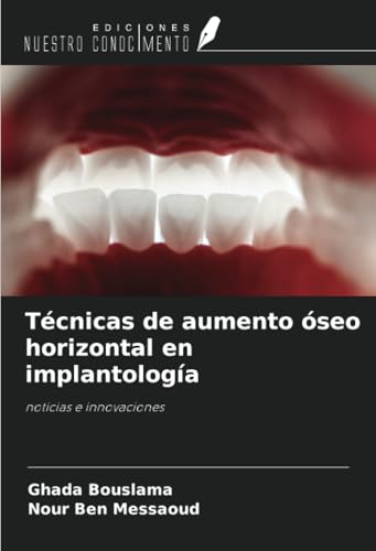 Técnicas de aumento óseo horizontal en implantología: noticias e innovaciones von Ediciones Nuestro Conocimiento