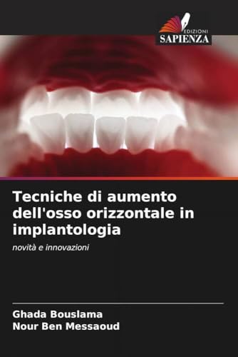 Tecniche di aumento dell'osso orizzontale in implantologia: novità e innovazioni von Edizioni Sapienza